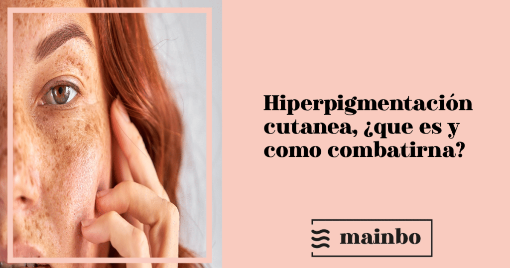 Hiperpigmentación